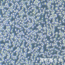 EL4（小鼠淋巴瘤细胞）