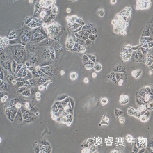 HuH-6（人肝母细胞瘤细胞）