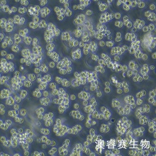 SP2/0（小鼠骨髓瘤细胞）