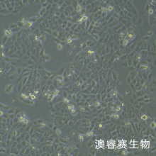 CAL 27（人舌鳞癌细胞）