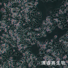 NCI-H520（人肺鳞癌细胞）