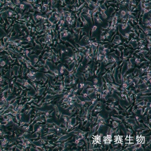 SK-N-BE2（人神经母细胞瘤细胞）