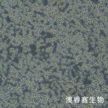 B95-8（绒猴EB病毒转化的白细胞）