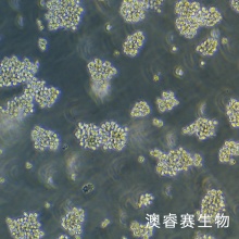 B95-8（绒猴EB病毒转化的白细胞）