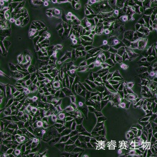 MHCC97-L（人低转移肝癌细胞）