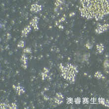 NK-92（人恶性非霍奇金淋巴瘤患者的自然杀伤细胞）