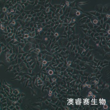 CNE（人鼻咽癌细胞）