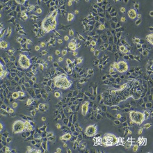 NCI-H508[H508]（人结肠直肠腺癌细胞）