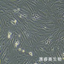 HSF（人皮肤成纤维细胞）