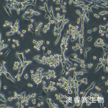 LLC（小鼠肺癌细胞）