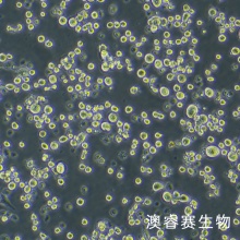 LLC（小鼠肺癌细胞）