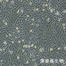 SV40-MES-13（小鼠肾小球系膜细胞）