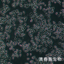 INS-1（大鼠胰岛细胞瘤细胞）