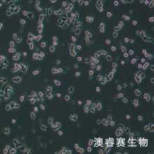 INS-1（大鼠胰岛细胞瘤细胞）