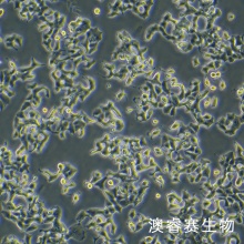 INS-1（大鼠胰岛细胞瘤细胞）