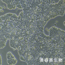 UACC-812（人乳腺导管瘤细胞）