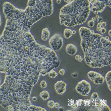 UACC-812（人乳腺导管瘤细胞）