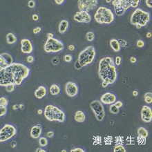 UACC-812（人乳腺导管瘤细胞）