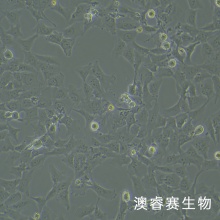 HCC38（人乳腺导管癌细胞）
