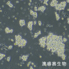 DMS-153（人小细胞肺癌）