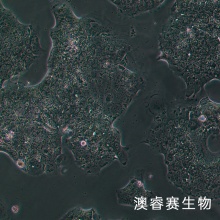 NCI-H2170（人肺鳞癌细胞）