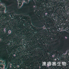 NCI-H2170（人肺鳞癌细胞）