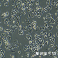 NCI-H295R [H295R] （人肾上腺皮质腺癌细胞）