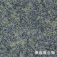 NG108-15 [108CC15]（小鼠神经细胞瘤与大鼠神经胶质瘤之融合细胞）