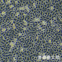 16HBE（人支气管上皮样细胞）