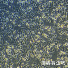 ID8（小鼠卵巢癌细胞）