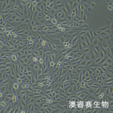 tpc-1（人甲状腺乳头状细胞）