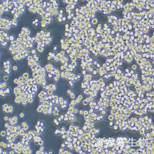 Walker/LLC-WRC 256（大鼠腹水癌细胞）