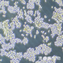 Walker/LLC-WRC 256（大鼠腹水癌细胞）