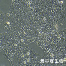 ZR-75-30（人乳腺癌细胞）