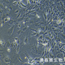 人肺微血管内皮细胞