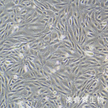 人冠状动脉内皮细胞