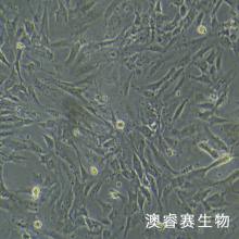 sNF96.2（人雪旺细胞神经纤维瘤病1型）