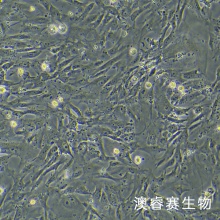 sNF96.2（人雪旺细胞神经纤维瘤病1型）