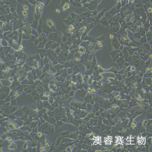 GL261-LUC（小鼠胶质瘤细胞带荧光素酶）