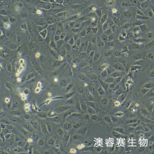 SK-OV-3/DDP（人卵巢腺癌顺铂耐药性细胞）
