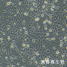 HTR-8/Svneo（人绒毛膜滋养细胞）