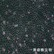 NPC/HK-1（人鼻咽癌细胞）