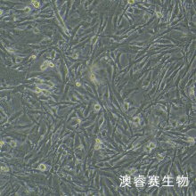 U251/GFP（人神经胶质细胞瘤细胞带绿色荧光）