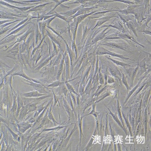 人子宫内膜间质细胞