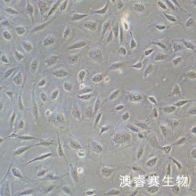 人子宫内膜上皮细胞