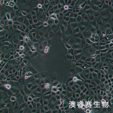 NIH:OVCAR-3 [OVCAR3]（人卵巢癌细胞）