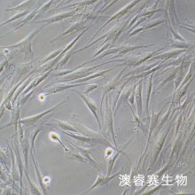 人关节滑膜成纤维细胞
