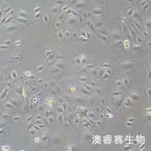 人附睾管上皮细胞