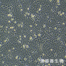 VX2 兔间变表皮鳞癌瘤株