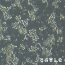 Y79（人视网膜母细胞瘤）